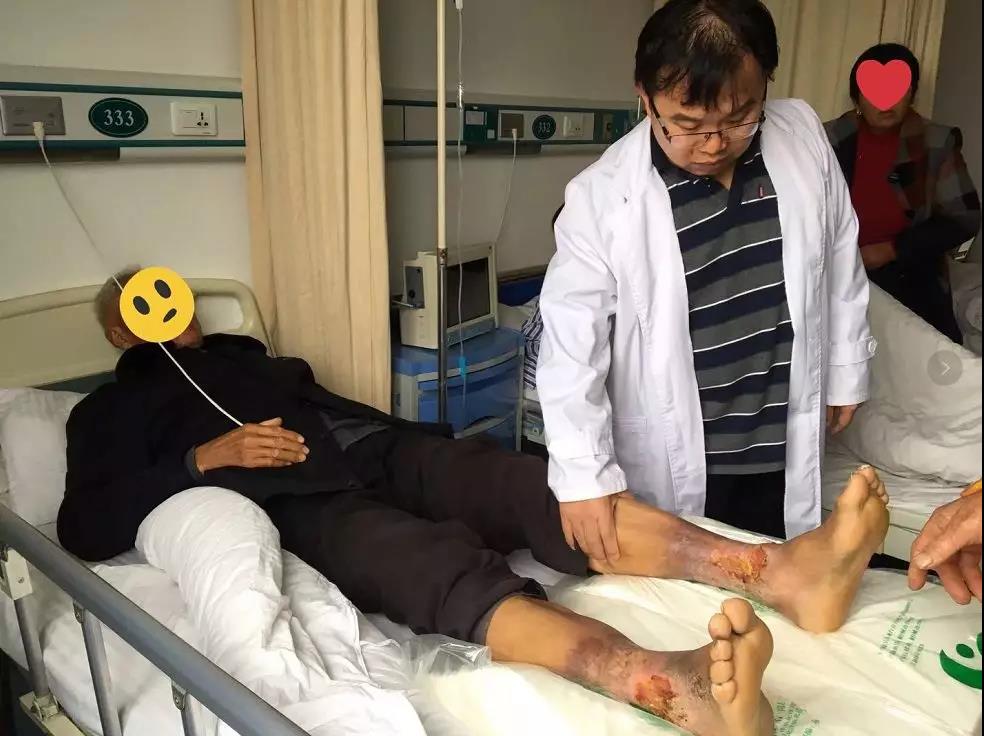 歐教授“周三教授親診日”，10名靜脈曲張幸運者得到診治！