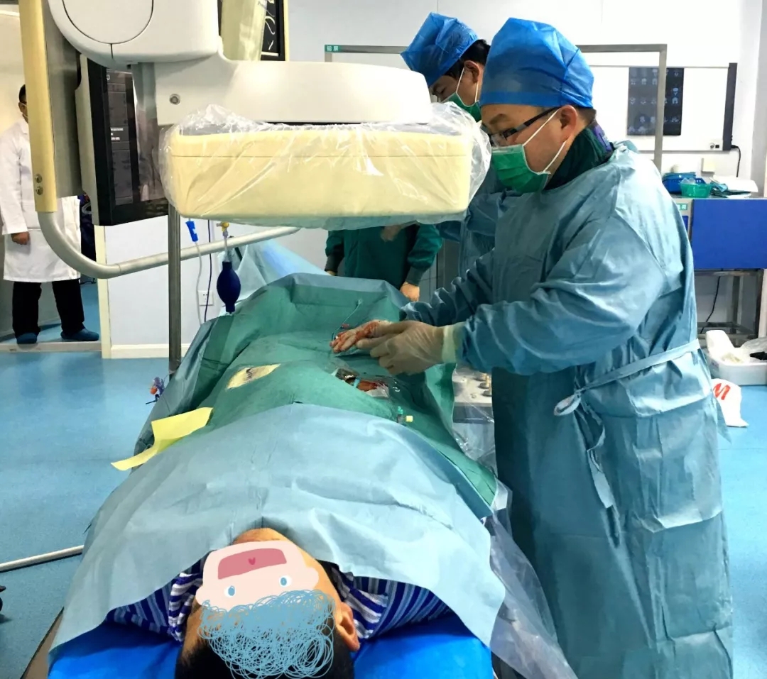 上海歐教授親赴鹽城操刀，介入術(shù)治療肝血管瘤，傷口僅有針眼大小